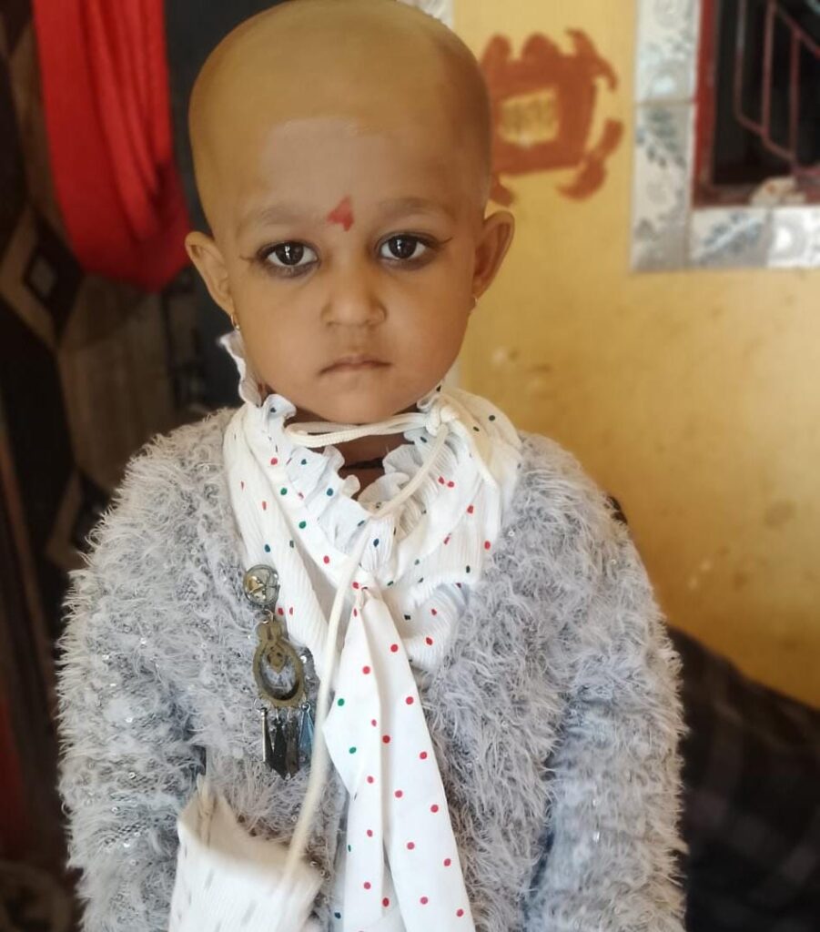 सौतेली मां पर 3 साल के बच्ची पर मारने का आरोप